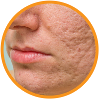 Nimbadi-Face-Cleanser-Benefits Nimbadi-Face-Cleanser-Benefits