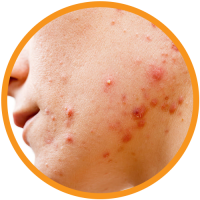 Retinol-Serum-Benefits5 Retinol-Serum-Benefits5