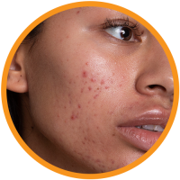 Retinol-Serum-Benefits6 Retinol-Serum-Benefits6