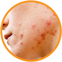 Goodbye-Blemishes-Vitamin-C-Face-Cream-Benefits-1 Goodbye-Blemishes-Vitamin-C-Face-Cream-Benefits-1