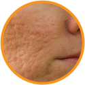 Goodbye-Blemishes-Vitamin-C-Face-Cream-Benefits-3 Goodbye-Blemishes-Vitamin-C-Face-Cream-Benefits-3