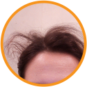 Red Onion OIL and Shampoo Combo Benefits-3 Red Onion OIL and Shampoo Combo Benefits-3