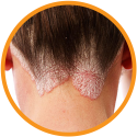 Red Onion OIL and Shampoo Combo Benefits-4 Red Onion OIL and Shampoo Combo Benefits-4