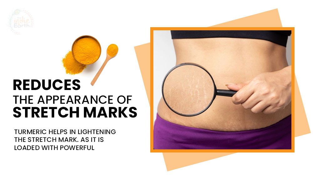 Reduces-the-appearance-of-stretch-marks