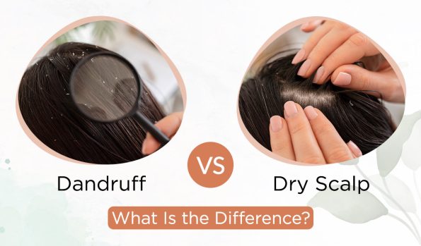 Dandruff-Vs-Dry-Scalp-What-Is-the-Difference