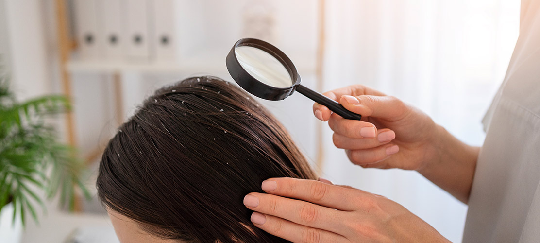 Difference-Between-Dandruff-And-Dry-Scalp
